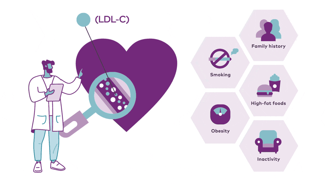 Illustration of doctor taking a deeper look at Bad (LDL-C) and some of the causes of bad cholesterol.